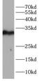 Low Density Lipoprotein Receptor Adaptor Protein 1 antibody, FNab00543, FineTest, Western Blot image 