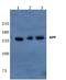 Amyloid Beta Precursor Protein antibody, AP06009PU-N, Origene, Western Blot image 