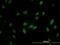 RNA Guanine-7 Methyltransferase antibody, LS-C133565, Lifespan Biosciences, Immunofluorescence image 