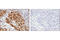 Yes Associated Protein 1 antibody, 13008S, Cell Signaling Technology, Immunohistochemistry paraffin image 