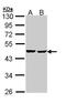 Succinate-CoA Ligase ADP-Forming Beta Subunit antibody, LS-C186095, Lifespan Biosciences, Western Blot image 