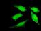 PR/SET Domain 4 antibody, H00011108-M04, Novus Biologicals, Immunocytochemistry image 
