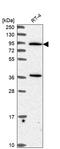 Phospholipase C Delta 3 antibody, HPA053665, Atlas Antibodies, Western Blot image 