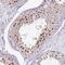 Chromosome 19 Open Reading Frame 33 antibody, NBP2-14392, Novus Biologicals, Immunohistochemistry paraffin image 