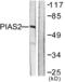Protein Inhibitor Of Activated STAT 2 antibody, LS-B11347, Lifespan Biosciences, Western Blot image 