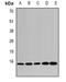 U6 snRNA-associated Sm-like protein LSm4 antibody, orb340991, Biorbyt, Western Blot image 