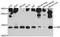 SCA2 antibody, A10225, ABclonal Technology, Western Blot image 
