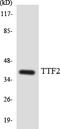 Forkhead box protein E1 antibody, LS-C292204, Lifespan Biosciences, Western Blot image 