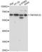 TNF Receptor Superfamily Member 25 antibody, A14261, ABclonal Technology, Western Blot image 
