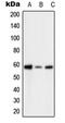 6-Phosphofructo-2-Kinase/Fructose-2,6-Biphosphatase 2 antibody, MBS821332, MyBioSource, Western Blot image 