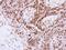 DNA damage-binding protein 1 antibody, LS-C185341, Lifespan Biosciences, Immunohistochemistry frozen image 