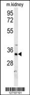 Hydroxysteroid 17-Beta Dehydrogenase 13 antibody, 62-022, ProSci, Western Blot image 