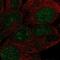 Zinc Finger Protein 429 antibody, NBP2-55107, Novus Biologicals, Immunocytochemistry image 