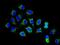 Succinate Dehydrogenase Complex Flavoprotein Subunit A antibody, ab137040, Abcam, Immunofluorescence image 