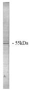Protein Phosphatase 2 Scaffold Subunit Abeta antibody, AP05042PU-N, Origene, Western Blot image 