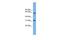 Microtubule Interacting And Trafficking Domain Containing 1 antibody, GTX45732, GeneTex, Western Blot image 