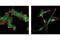 SMAD Family Member 3 antibody, 9523T, Cell Signaling Technology, Immunofluorescence image 