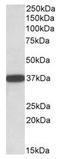 Cytochrome B5 Reductase 3 antibody, AP23662PU-N, Origene, Western Blot image 