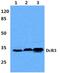 TNF Receptor Superfamily Member 6b antibody, GTX66684, GeneTex, Western Blot image 
