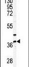 Pantothenate Kinase 3 antibody, PA5-13963, Invitrogen Antibodies, Western Blot image 