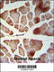 PAT1 Homolog 1, Processing Body MRNA Decay Factor antibody, 64-121, ProSci, Immunohistochemistry paraffin image 