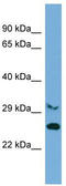 Proline And Serine Rich 2 antibody, TA330935, Origene, Western Blot image 