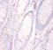 Annexin A5 antibody, A51897-100, Epigentek, Immunohistochemistry paraffin image 