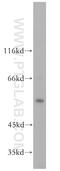 Membrane Palmitoylated Protein 1 antibody, 14715-1-AP, Proteintech Group, Western Blot image 