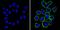 ERBB2 antibody, MA5-13675, Invitrogen Antibodies, Immunofluorescence image 