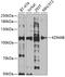 Lysine-specific demethylase 4B antibody, 19-883, ProSci, Western Blot image 