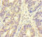 Microtubule Associated Protein RP/EB Family Member 1 antibody, LS-C395211, Lifespan Biosciences, Immunohistochemistry paraffin image 