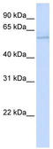 Mitochondrially Encoded NADH:Ubiquinone Oxidoreductase Core Subunit 5 antibody, TA342086, Origene, Western Blot image 