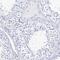 Filaggrin antibody, NBP1-87527, Novus Biologicals, Immunohistochemistry paraffin image 