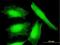 Nucleoredoxin antibody, H00064359-B01P, Novus Biologicals, Immunocytochemistry image 