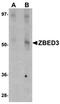 Zinc Finger BED-Type Containing 3 antibody, orb75180, Biorbyt, Western Blot image 