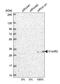 Chromosome 1 Open Reading Frame 52 antibody, NBP1-93751, Novus Biologicals, Western Blot image 