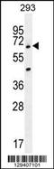 Ankyrin Repeat Domain 34B antibody, TA324405, Origene, Western Blot image 