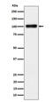 Spectrin Repeat Containing Nuclear Envelope Family Member 3 antibody, M13164-1, Boster Biological Technology, Western Blot image 