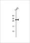 Cardiolipin Synthase 1 antibody, 61-923, ProSci, Western Blot image 