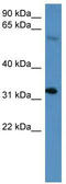 Homeobox D13 antibody, TA329720, Origene, Western Blot image 