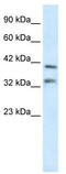 GS Homeobox 2 antibody, TA330200, Origene, Western Blot image 