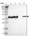 DnaJ Heat Shock Protein Family (Hsp40) Member B12 antibody, NBP1-85208, Novus Biologicals, Western Blot image 