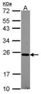 NADH:Ubiquinone Oxidoreductase Subunit B10 antibody, NBP2-19503, Novus Biologicals, Western Blot image 