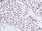 Pre-MRNA Processing Factor 39 antibody, LS-C185673, Lifespan Biosciences, Immunohistochemistry paraffin image 