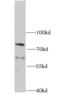 Proprotein Convertase Subtilisin/Kexin Type 9 antibody, FNab06227, FineTest, Western Blot image 