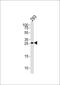 TGFB Induced Factor Homeobox 2 antibody, PA5-35157, Invitrogen Antibodies, Western Blot image 