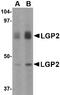 Probable ATP-dependent RNA helicase DHX58 antibody, AP22612PU-N, Origene, Western Blot image 