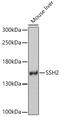Slingshot Protein Phosphatase 2 antibody, GTX64962, GeneTex, Western Blot image 