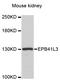Erythrocyte Membrane Protein Band 4.1 Like 3 antibody, STJ114632, St John