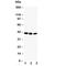 C-C Motif Chemokine Receptor 6 antibody, R30301, NSJ Bioreagents, Western Blot image 